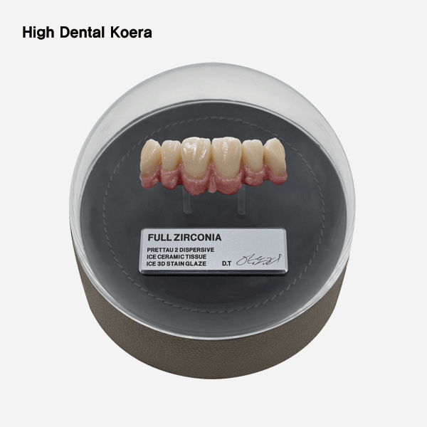 개인 소장용 지르코니아 6전치 커스텀 오르골High Dental korea (하이덴탈코리아)